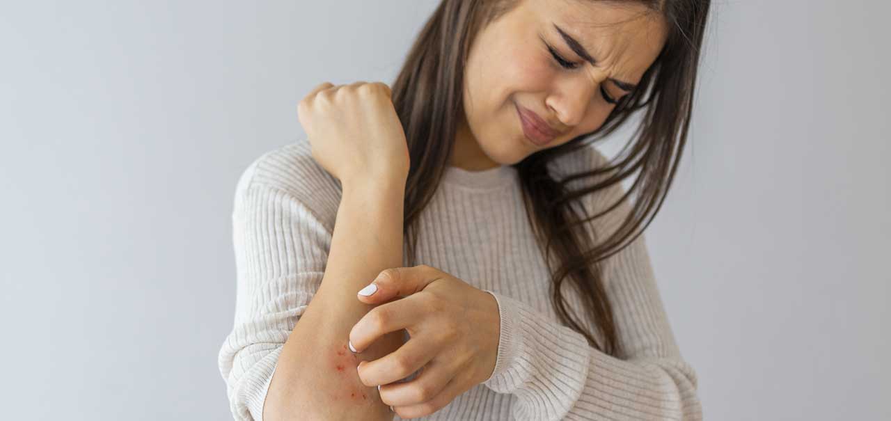 Allergien – eine Plage für Betroffene ©stock.adobe.com ValentinValkov
