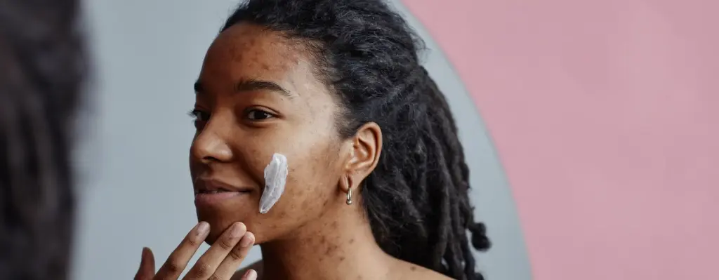 Eine jüngere Frau mit Hautirritationen schmiert sich Creme auf die Wange und blickt in einen Spiegel. Das Bild wird im Bereich "Akne - Behandlung mit Lichttherapie" verwendet.