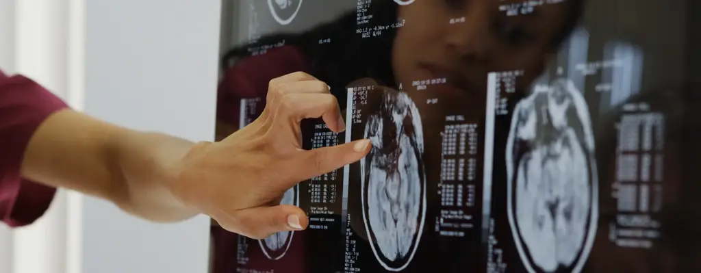 Das Bild zeigt eine Hand einer medizinischen Fachperson, die auf einen Bereich eines Röntgenbild zeigt. In der Spiegelung sieht man das Gesicht einer weiblichen Person. Das Bild wird im Bereich "ZAP-X-Behandlung im Bonifatius Hospital Lingen (Ems)" verwendet.